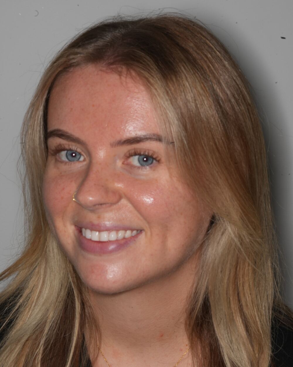 Ellie, treatment coordinator